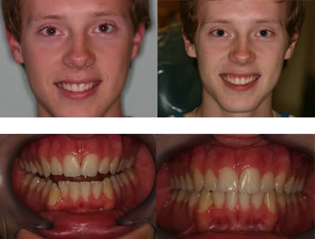 Dental Patient Before & After
