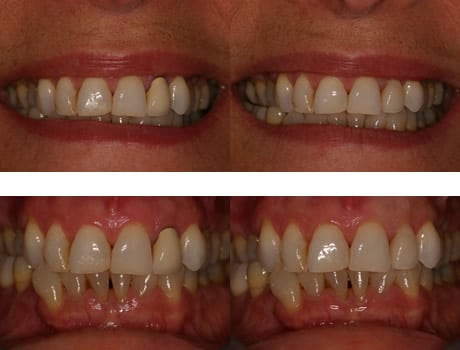 Dental Patient Before & After